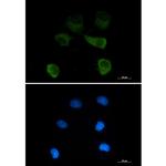 TUBG1 Recombinant Rabbit Monoclonal Antibody (K01_2M49)
