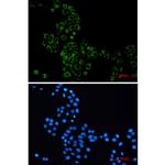 GBP1 Recombinant Rabbit Monoclonal Antibody (K01_2M50)