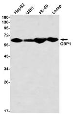GBP1 Antibody in Western Blot (WB)