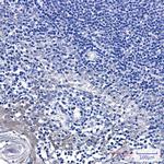 GCLM Antibody in Immunohistochemistry (Paraffin) (IHC (P))