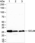 GCLM Antibody in Western Blot (WB)