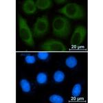 G6PD Recombinant Rabbit Monoclonal Antibody (K01_2M53)