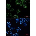 GNAI2 Recombinant Rabbit Monoclonal Antibody (K01_2M56)