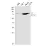 GRK2 Recombinant Rabbit Monoclonal Antibody (K01_2M57)