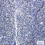 GTPBP4 Recombinant Rabbit Monoclonal Antibody (K01_2M59)