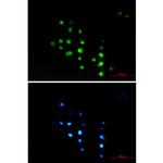HCE Recombinant Rabbit Monoclonal Antibody (K01_2M60)