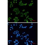HCK Recombinant Rabbit Monoclonal Antibody (K01_2M61)