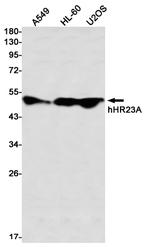 RAD23A Recombinant Rabbit Monoclonal Antibody (K01_2M64)