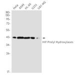 P4HTM Antibody in Western Blot (WB)