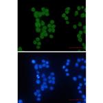 HIPK2 Recombinant Rabbit Monoclonal Antibody (K01_2M70)