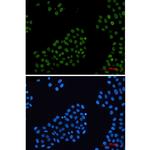 Histone H2A.X Recombinant Rabbit Monoclonal Antibody (K01_2M71)