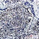 HJURP Recombinant Rabbit Monoclonal Antibody (K01_2M72)