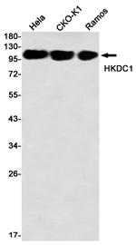 HKDC1 Recombinant Rabbit Monoclonal Antibody (K01_2M73)