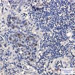 HMG4 Recombinant Rabbit Monoclonal Antibody (K01_2M75)