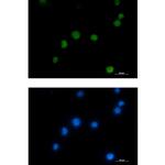 HMGB2 Recombinant Rabbit Monoclonal Antibody (K01_2M76)