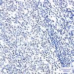 HMGB2 Antibody in Immunohistochemistry (Paraffin) (IHC (P))