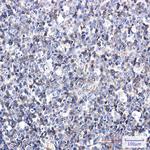 ICAM3 Recombinant Rabbit Monoclonal Antibody (K01_2M82)