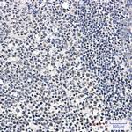 IKZF3 Recombinant Rabbit Monoclonal Antibody (K01_2M87)