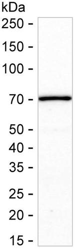 IKZF3 Antibody in Western Blot (WB)