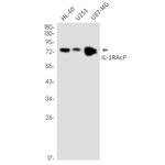 IL-1RAcP Recombinant Rabbit Monoclonal Antibody (K01_2M88)