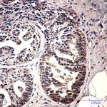 IMPDH2 Antibody in Immunohistochemistry (Paraffin) (IHC (P))