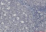 Ku70 Antibody in Immunohistochemistry (Paraffin) (IHC (P))