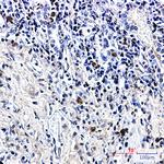 LTK Recombinant Rabbit Monoclonal Antibody (K01_2N14)