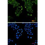 Metadherin Recombinant Rabbit Monoclonal Antibody (K01_2N15)