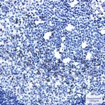 Metadherin Antibody in Immunohistochemistry (Paraffin) (IHC (P))