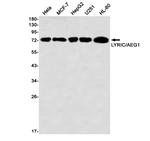 Metadherin Antibody in Western Blot (WB)