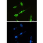 Metadherin Recombinant Rabbit Monoclonal Antibody (K01_2N16)