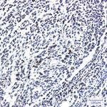 Metadherin Antibody in Immunohistochemistry (Paraffin) (IHC (P))