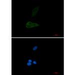 MEKK4 Recombinant Rabbit Monoclonal Antibody (K01_2N19)