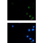 ME2 Antibody in Immunocytochemistry (ICC/IF)