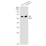 ME2 Antibody in Western Blot (WB)