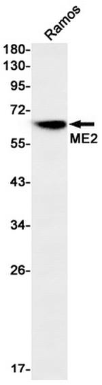 ME2 Antibody in Western Blot (WB)