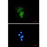 TMEM67 Recombinant Rabbit Monoclonal Antibody (K01_2N24)
