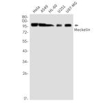 TMEM67 Antibody in Western Blot (WB)