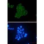 MEK2 Recombinant Rabbit Monoclonal Antibody (K01_2N25)