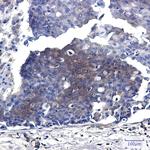 MEK2 Antibody in Immunohistochemistry (Paraffin) (IHC (P))