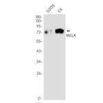 MELK Recombinant Rabbit Monoclonal Antibody (K01_2N26)
