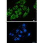 Moesin Recombinant Rabbit Monoclonal Antibody (K01_2N34)