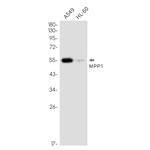 MPP1 Recombinant Rabbit Monoclonal Antibody (K01_2N35)