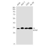 MTAP Recombinant Rabbit Monoclonal Antibody (K01_2N38)