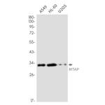 MTAP Recombinant Rabbit Monoclonal Antibody (K01_2N40)