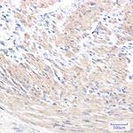 ACTA1 Antibody in Immunohistochemistry (Paraffin) (IHC (P))