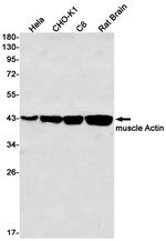ACTA1 Antibody in Western Blot (WB)