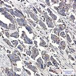 NDUFS1 Antibody in Immunohistochemistry (Paraffin) (IHC (P))