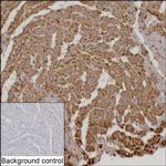 NDUFS2 Recombinant Rabbit Monoclonal Antibody (K01_2N47)