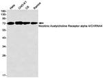 CHRNA4 Recombinant Rabbit Monoclonal Antibody (K01_2N54)
